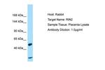 RIN2 Antibody in Western Blot (WB)
