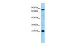 MED22 Polyclonal Antibody