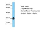 CDV3 Polyclonal Antibody