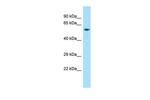 D2HGDH Polyclonal Antibody