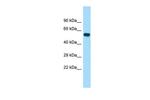 PIP5K1B Polyclonal Antibody