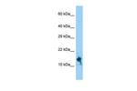 IGFL1 Polyclonal Antibody