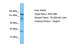KIAA1462 Polyclonal Antibody