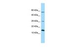 NDUFB4 Polyclonal Antibody