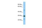 SIRPB2 Polyclonal Antibody