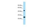 TMBIM4 Antibody in Western Blot (WB)