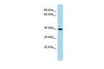 CWC25 Polyclonal Antibody
