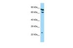 THOC7 Polyclonal Antibody