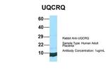 UQCRQ Polyclonal Antibody