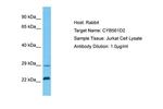 CYB561D2 Polyclonal Antibody