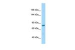 DCDC5 Polyclonal Antibody