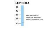 LEPROTL1 Antibody in Western Blot (WB)
