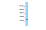 LEPROTL1 Polyclonal Antibody