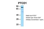PTCD1 Antibody in Western Blot (WB)