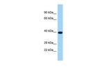 TICAM2 Polyclonal Antibody
