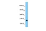TEFM Polyclonal Antibody