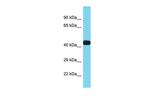 CXorf36 Polyclonal Antibody