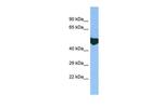 EXD2 Polyclonal Antibody