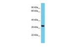 ATP5SL Polyclonal Antibody