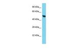 TIMM50 Polyclonal Antibody