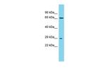 CCDC124 Polyclonal Antibody