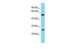 ANKRD18A Polyclonal Antibody