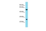 DNAAF3 Polyclonal Antibody