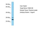 FAM212B Antibody in Western Blot (WB)