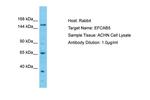 EFCAB5 Polyclonal Antibody