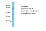 KRT76 Polyclonal Antibody
