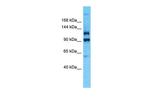 PLEKHG4B Polyclonal Antibody