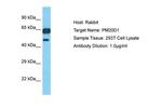 PM20D1 Antibody in Western Blot (WB)