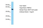 PMPCA Polyclonal Antibody