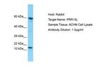 PRR15L Polyclonal Antibody