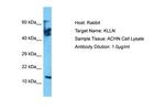 KLLN Polyclonal Antibody