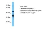 PRAMEF2 Polyclonal Antibody