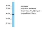PRAMEF19 Polyclonal Antibody