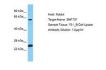 ZNF737 Polyclonal Antibody