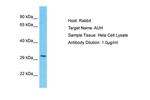 AUH Polyclonal Antibody
