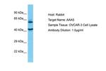 Aladin Polyclonal Antibody