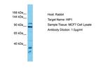HIP1 Polyclonal Antibody