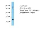 SAT2 Polyclonal Antibody