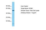 GCM2 Polyclonal Antibody