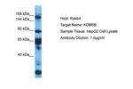 KDM5B Polyclonal Antibody