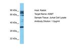 ASMT Polyclonal Antibody