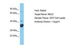 NEU2 Polyclonal Antibody