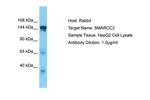 SMARCC2 Polyclonal Antibody