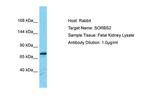 ARGBP2 Polyclonal Antibody