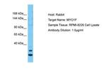 MYO1F Polyclonal Antibody