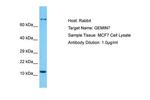 Gemin 7 Polyclonal Antibody
